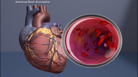 Healthier Together: Understanding heart disease
