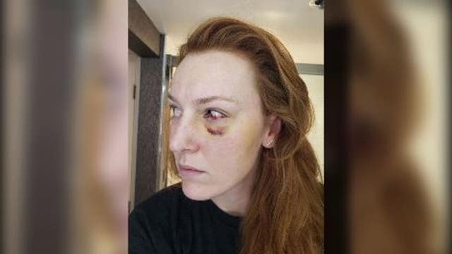 3 women attacked in separate, random attacks in Seattle in less than 48 hours