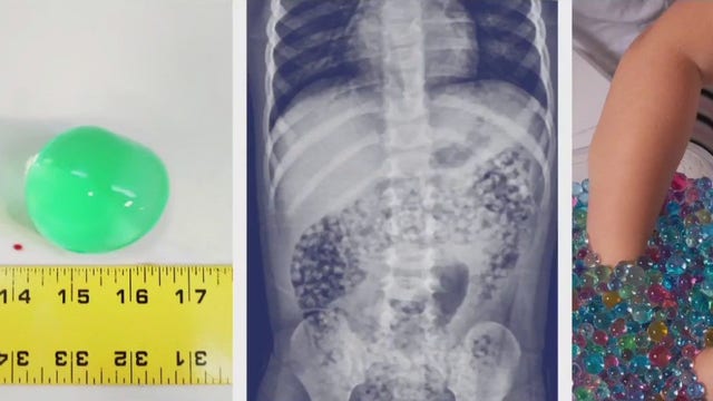 Health professionals warn holiday gifts could cause toy-related injuries if kids aren't careful