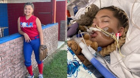 'Brave' teenager gets legs amputated while comatose after contracting infection on Christmas