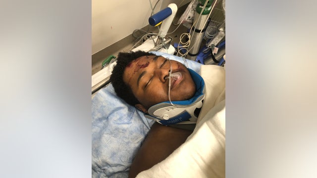 'He deserves better than this:' Family upset after young father was left for dead by suspected drunk driver