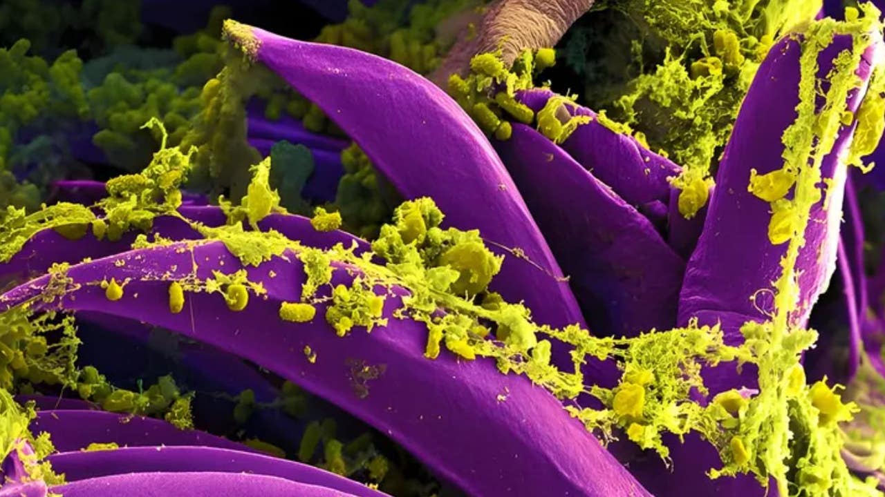 Първият случай на бубонна чума при хора, потвърден в Орегон от здравните служители от 2015 г