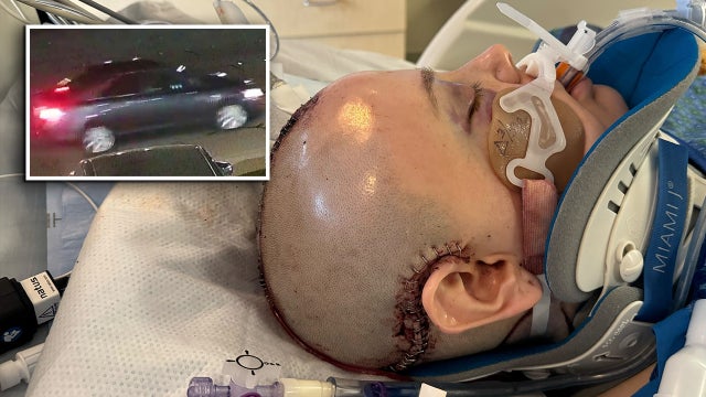 Woman dies after Lynnwood hit-and-run, family searching for driver responsible