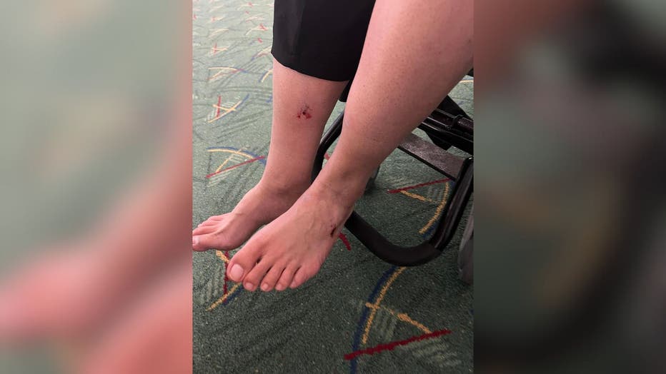 Tran’s injured foot from mid-flight blowout