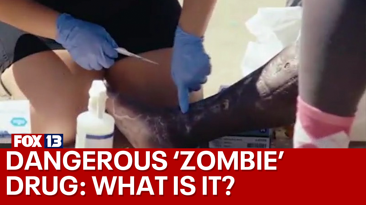 'Zombie drug' tranq being sold as standalone first time ever - Vimarsana News
