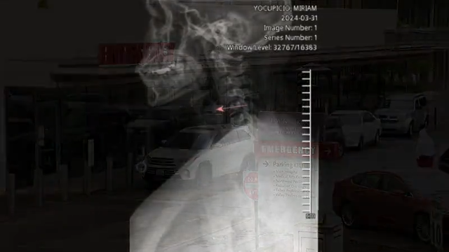 '2 bites could have killed me': Seattle woman sues Panda Express over wire in meal