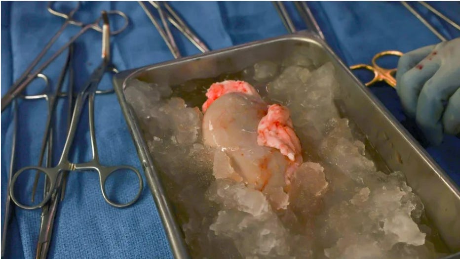 The pig kidney sits on ice, awaiting transplantation. (Credit: Massachusetts General Hospital)