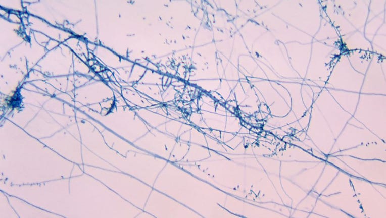 FILE - Photomicrograph of zoophilic fungus Trichophyton mentagrophytes. Image courtesy CDC/Dr. Leanor Haley. (Photo via Smith Collection/Gado/Getty Images).