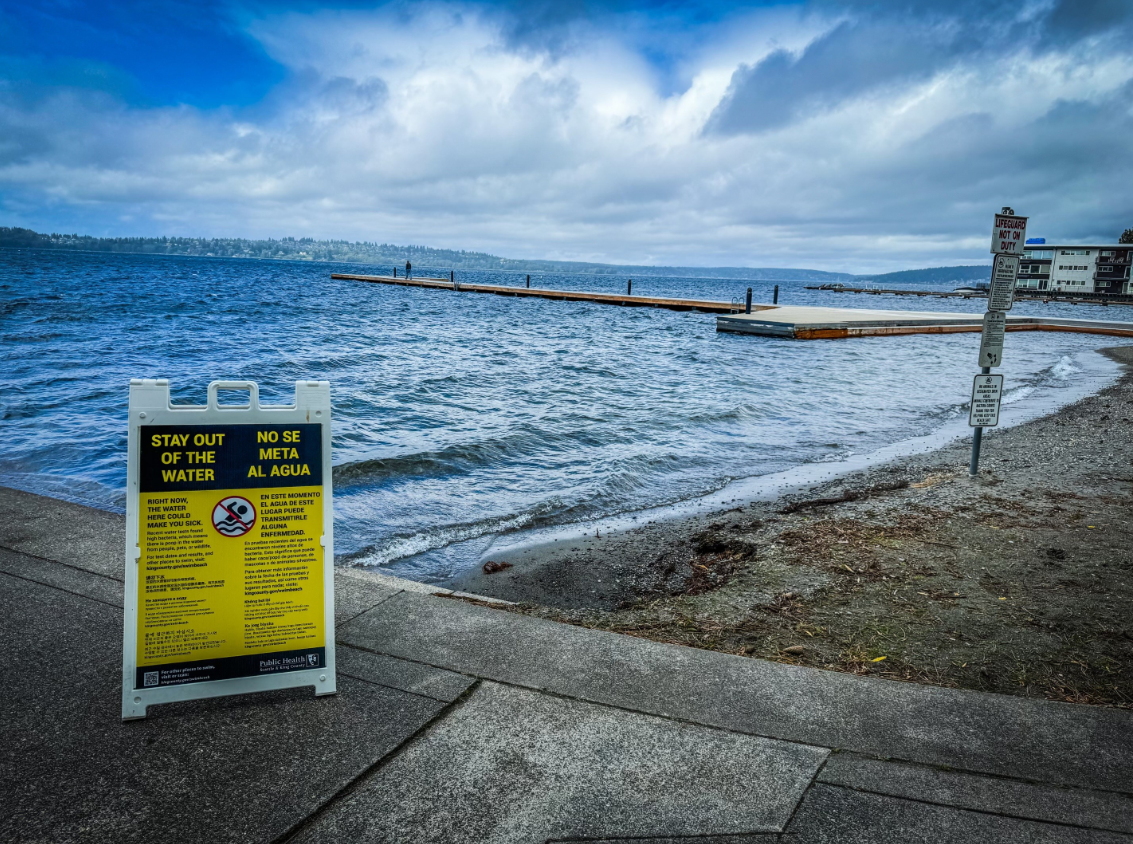 King County, WA closes 5 beaches due to high bacteria