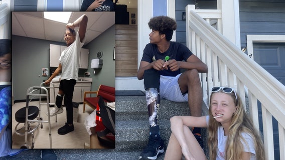 Marysville teen who lost foot in fireworks accident shares warning