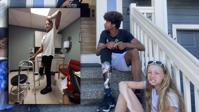 Marysville teen who lost foot in fireworks accident shares warning