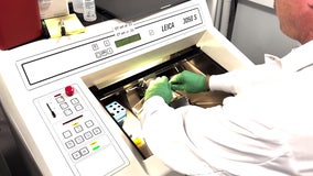 New discoveries from Seattle scientists could help manage brain's aging process