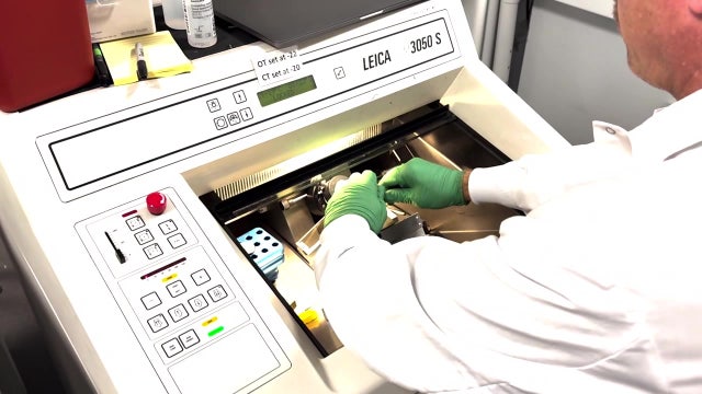 New discoveries from Seattle scientists could help manage brain's aging process