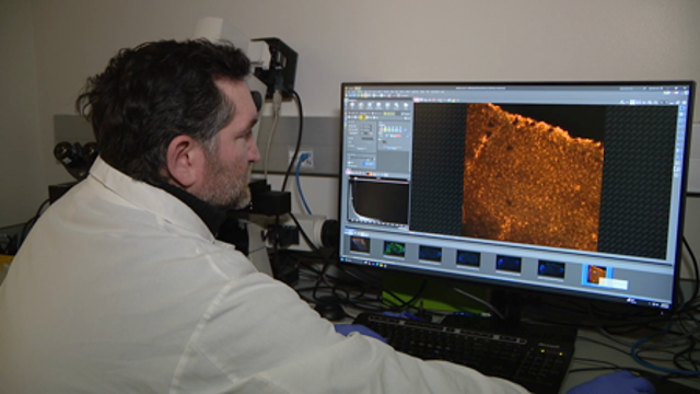 Breakthrough gene therapy in Seattle offers hope for children with epilepsy