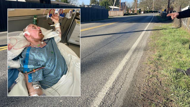 Snohomish County dad critically injured after hit-and-run crash