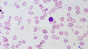 Health experts say ‘harmless’ symptoms could be signs of blood disease