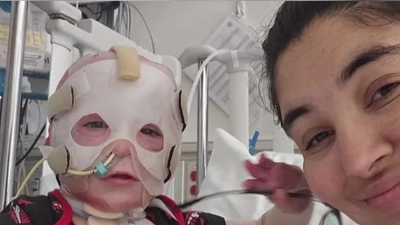 Port Angeles, WA baby burned in house fire spends months recovering in Seattle