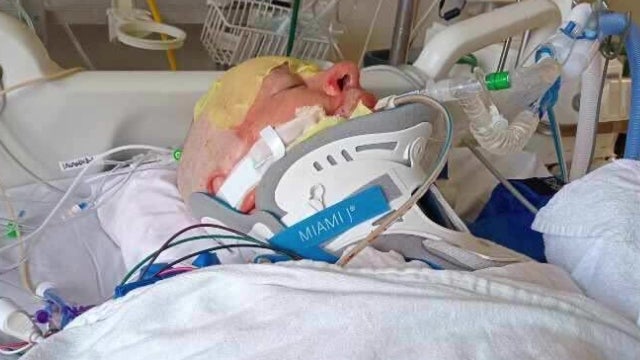 Community rallies around man burned in Tacoma, WA fire