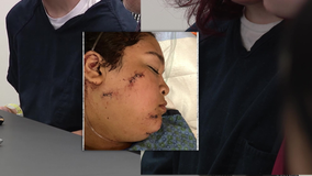 2 teens charged with assault in violent West Seattle stabbing