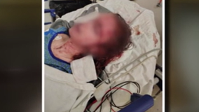 Family calls for 'justice for Sunshine' as plea deal is discussed in graphic Queen Anne assault case