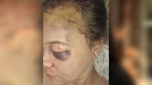 2 teens arrested in possible hate crime assault on WA transgender woman