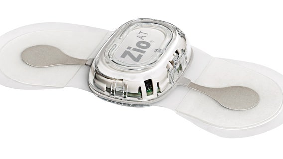 Pierce County, WA mom credits heart monitor for helping save her life from rare condition