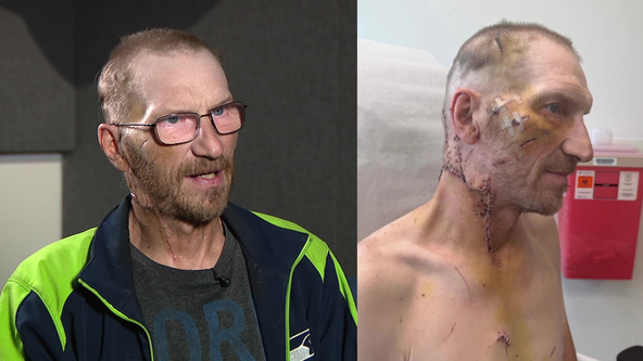 WA DoorDash driver speaks out after vicious attack