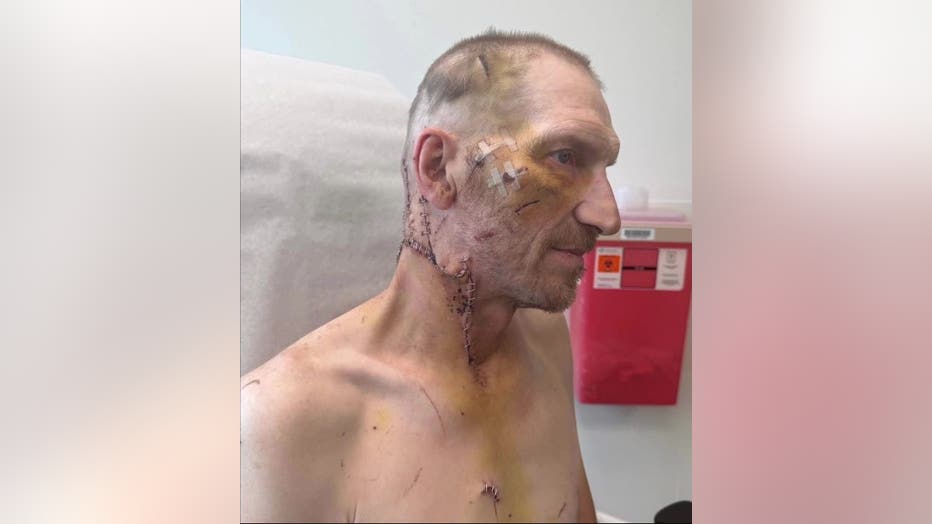 Melvin Swaggerty's injuries