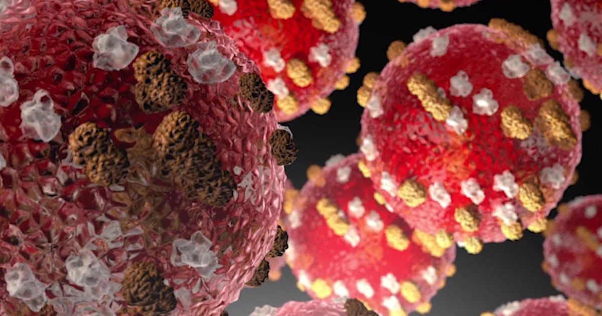 WA measles outbreak has health officials concerned over World Cup games