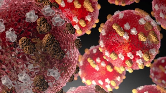 WA measles outbreak has health officials concerned over World Cup games