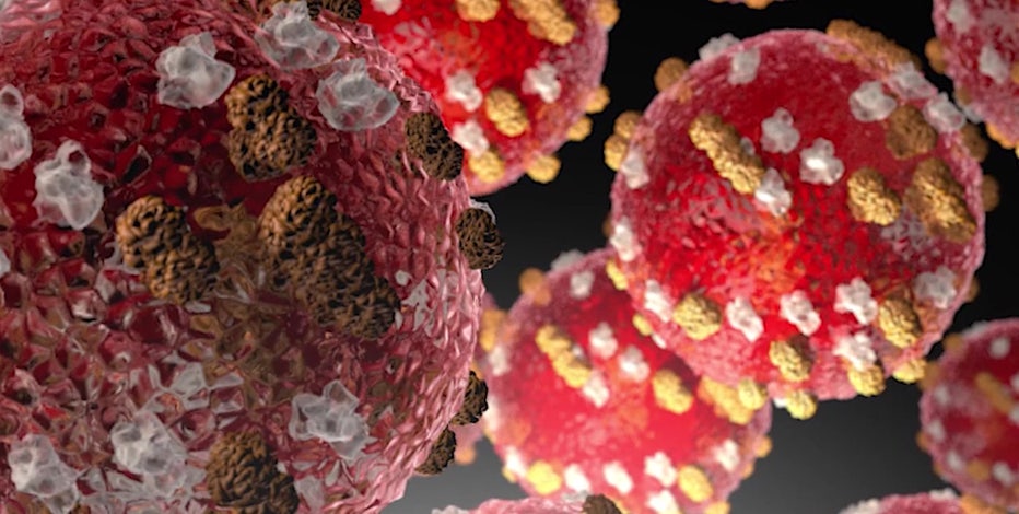 WA measles outbreak has health officials concerned over World Cup games