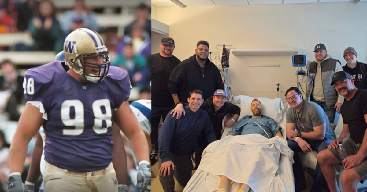 Former UW football player Dan Milsten battling cancer