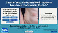 King Co. Health officials warn of new sexually transmitted infection