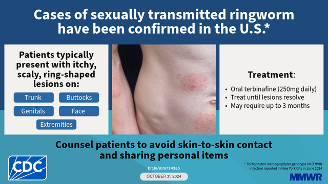 King Co. Health officials warn of new sexually transmitted infection