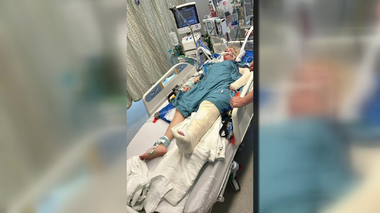 Woman faces long road to recovery after Lime bike crash on Seattle's Aurora Avenue