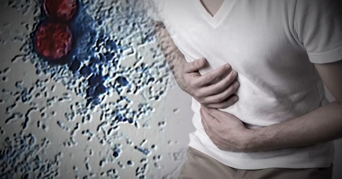 Cyclosporiasis in WA: Where the state stands as national outbreak surges