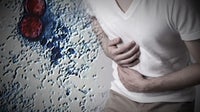Cyclosporiasis in WA: Where the state stands as national outbreak surges