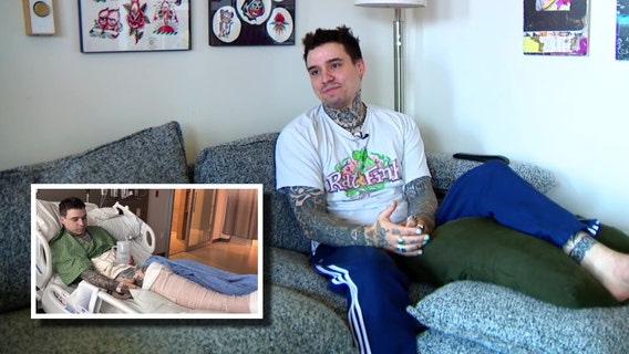 5 Point Café community rallies behind injured Seattle bartender