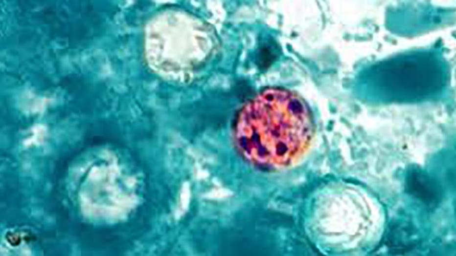 cyclosporiasis under microscope