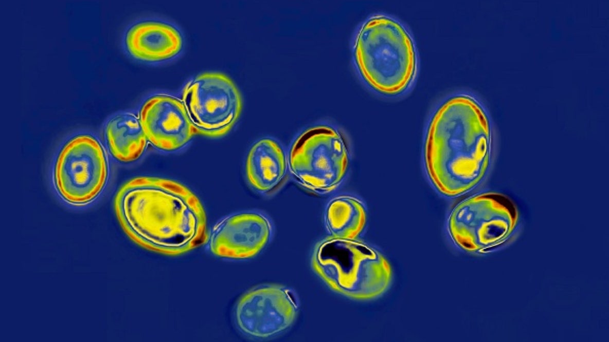 CDC: 13 cases in 2026 of new fungus in WA