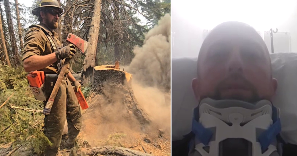 WA firefighter injured on Little Giant Fire front lines