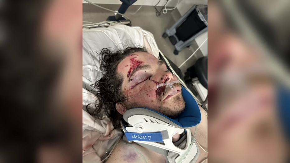 Jacob Royds At Harborview After E-Scooter Bus Crash