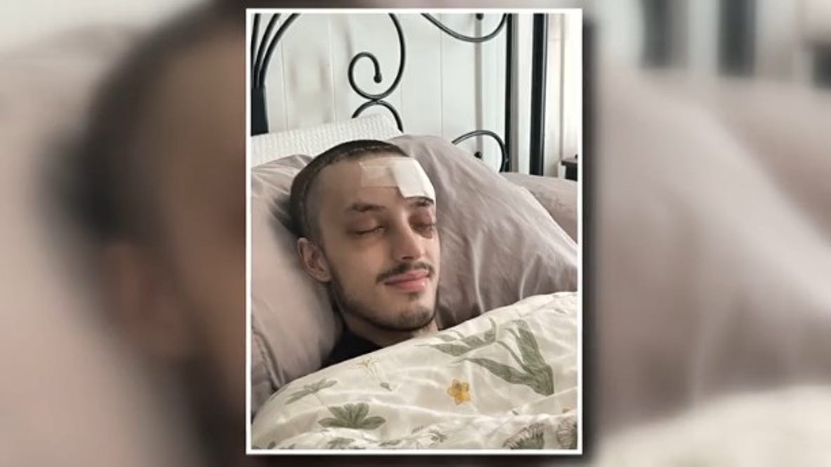 Seattle skateboarder recovering after South Lake Union hit-and-run
