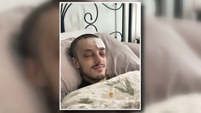 Seattle skateboarder recovering after South Lake Union hit-and-run