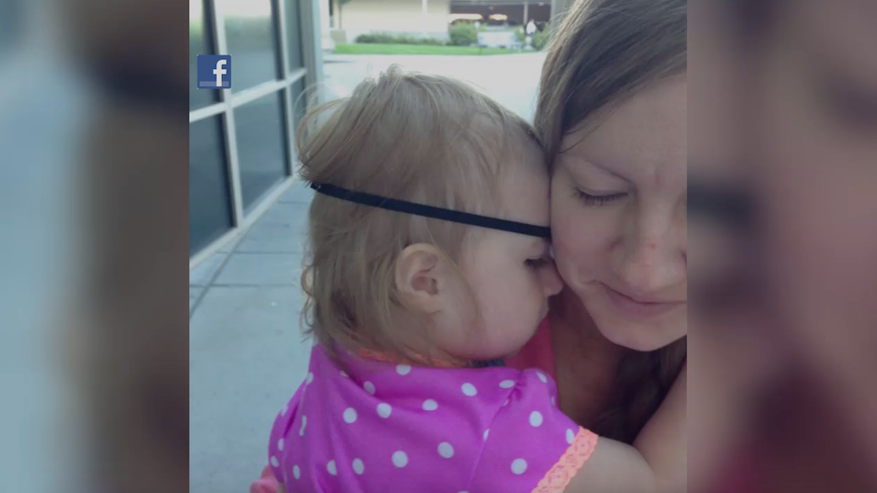 Child who lost eye to cancer gets special doll