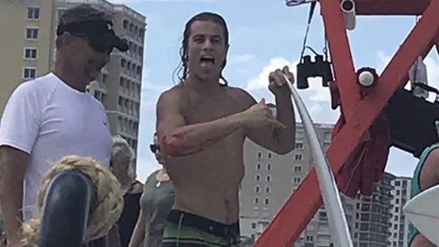 Florida surfer attacked by shark opts for bar instead of hospital
