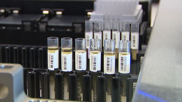 Florida gene study could determine your risk for an early heart attack