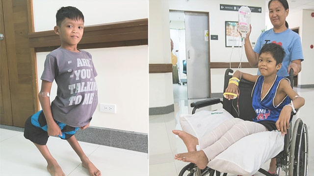 Tebow CURE Hospital corrects boy's leg deformity