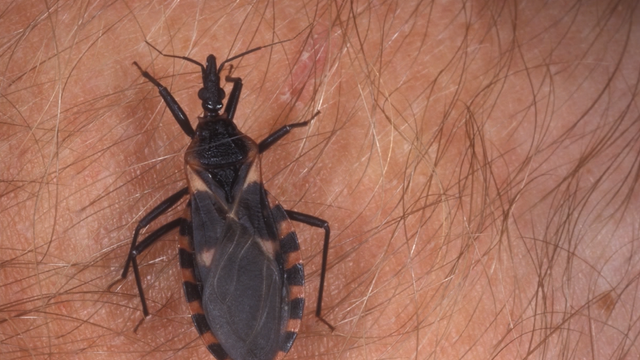 Potentially deadly 'kissing bug' spreading across the United States