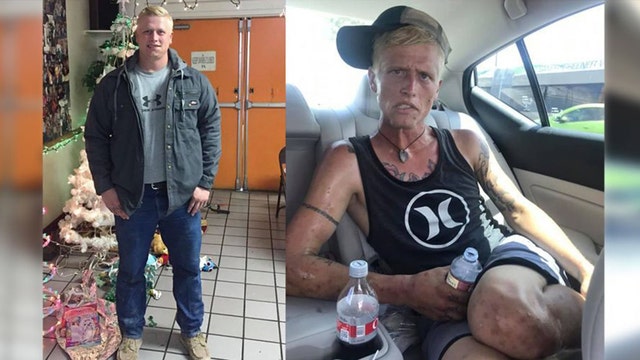 Mother shares heartbreaking before-and-after photos of son in throes of addiction